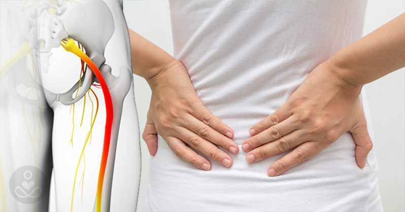 Get the Best Sciatica Pain Treatment at Specialist Pain