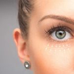 Non-Surgical Eye Bag Removal in Singapore: What You Need to Know