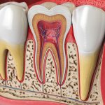 Pain During a Root Canal: Dispelling Myths and Embracing Realities in Drexel Hill